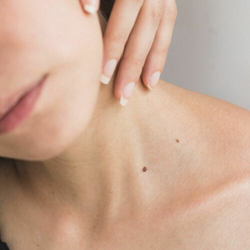 Skin Tag Removal